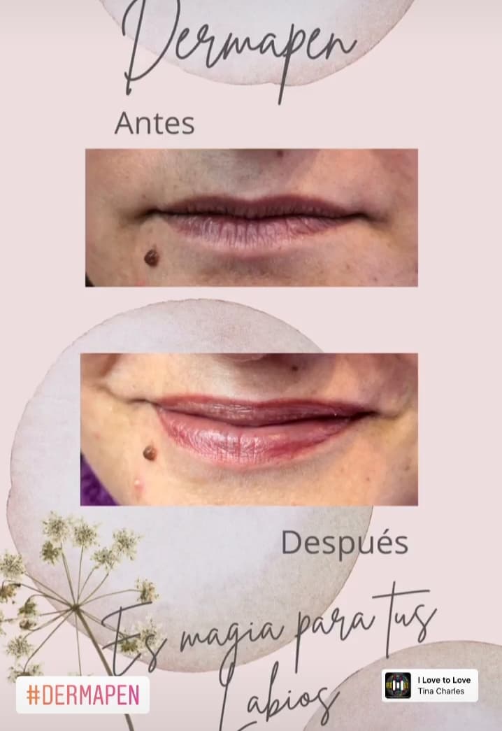Anxo's Peluquería & Estética en Cambre